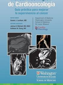 Manual Washington de Cardiooncología Guía práctica para mejorar la supervivencia al cáncer 