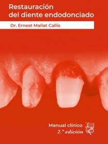 RESTAURACIÓN DEL DIENTE ENDODONCIADO manual clínico 2ª edición